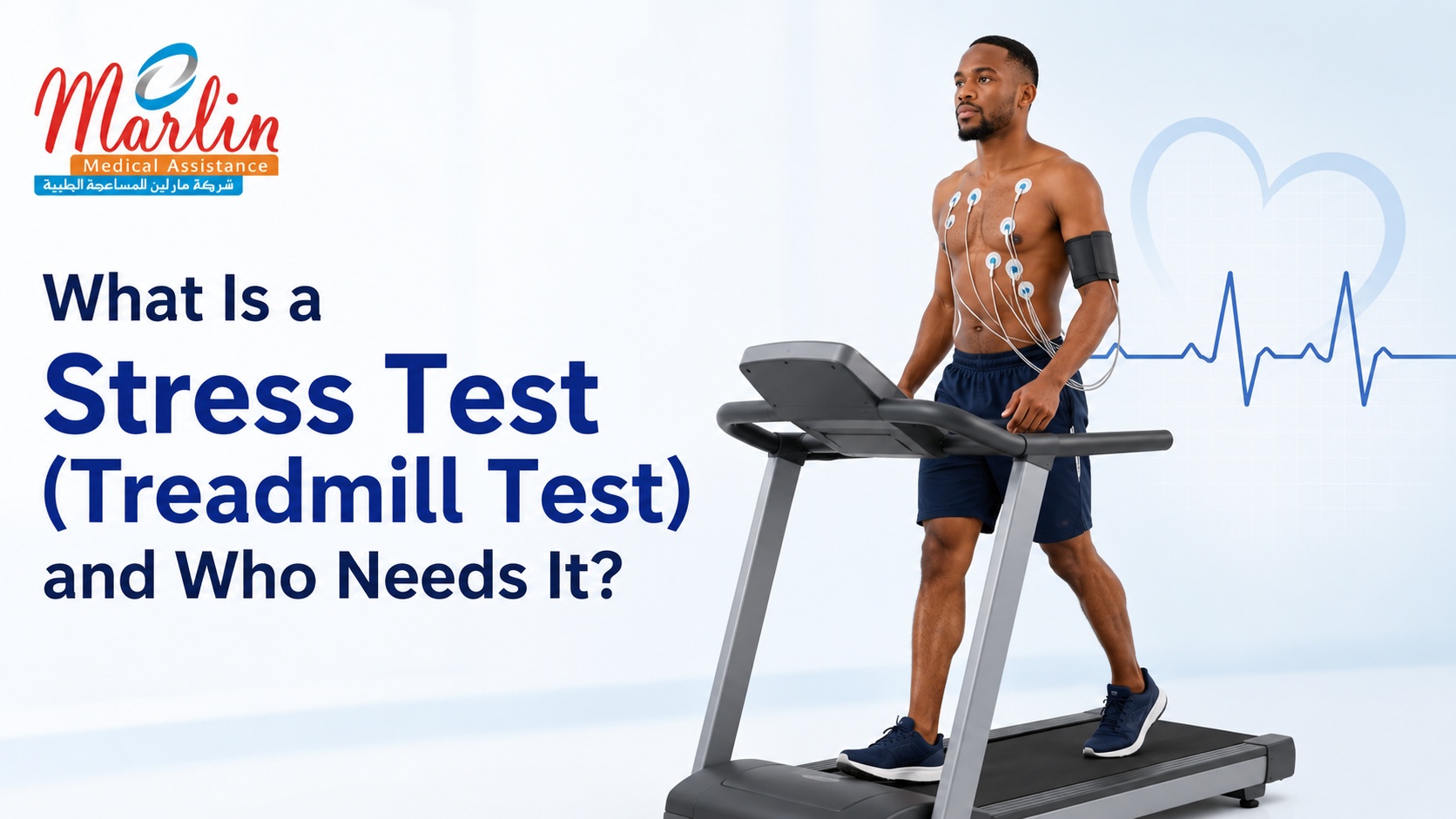 What Is a Stress Test (Treadmill Test) and Who Needs It? What Is a Stress Test (Treadmill Test) and Who Needs It?