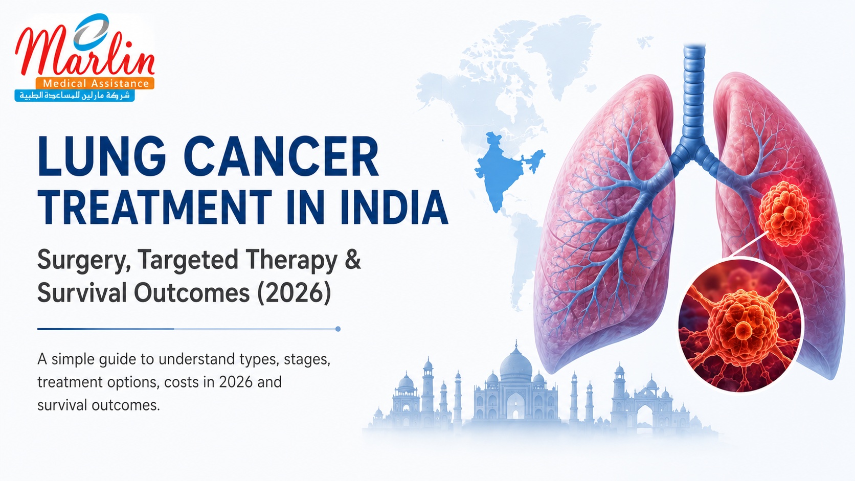 Lung Cancer Treatment in India: Surgery, Targeted Therapy & Survival Outcomes (2026) Lung Cancer Treatment in India: Surgery, Targeted Therapy & Survival Outcomes (2026)