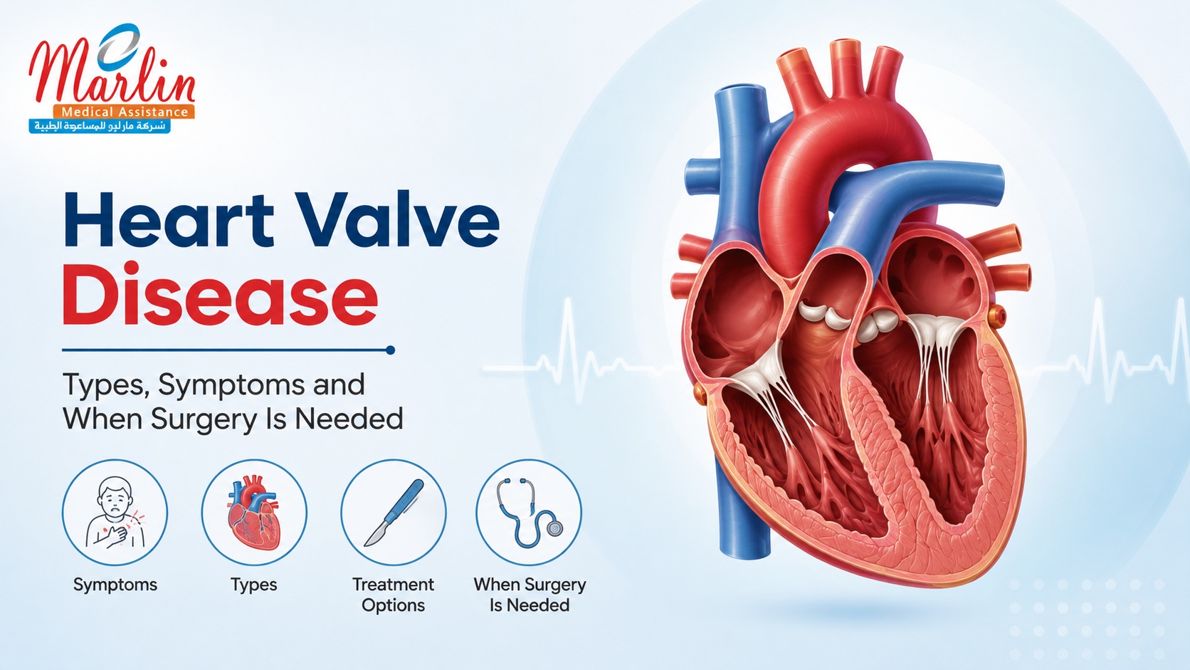 Heart Valve Disease: Types, Symptoms and When Surgery Is Needed