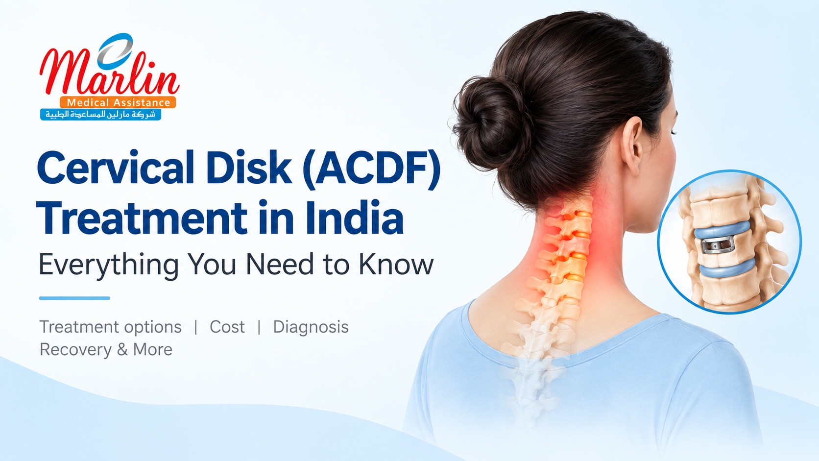 Cervical Disk (ACDF) Treatment in India: Everything That You Need to Know