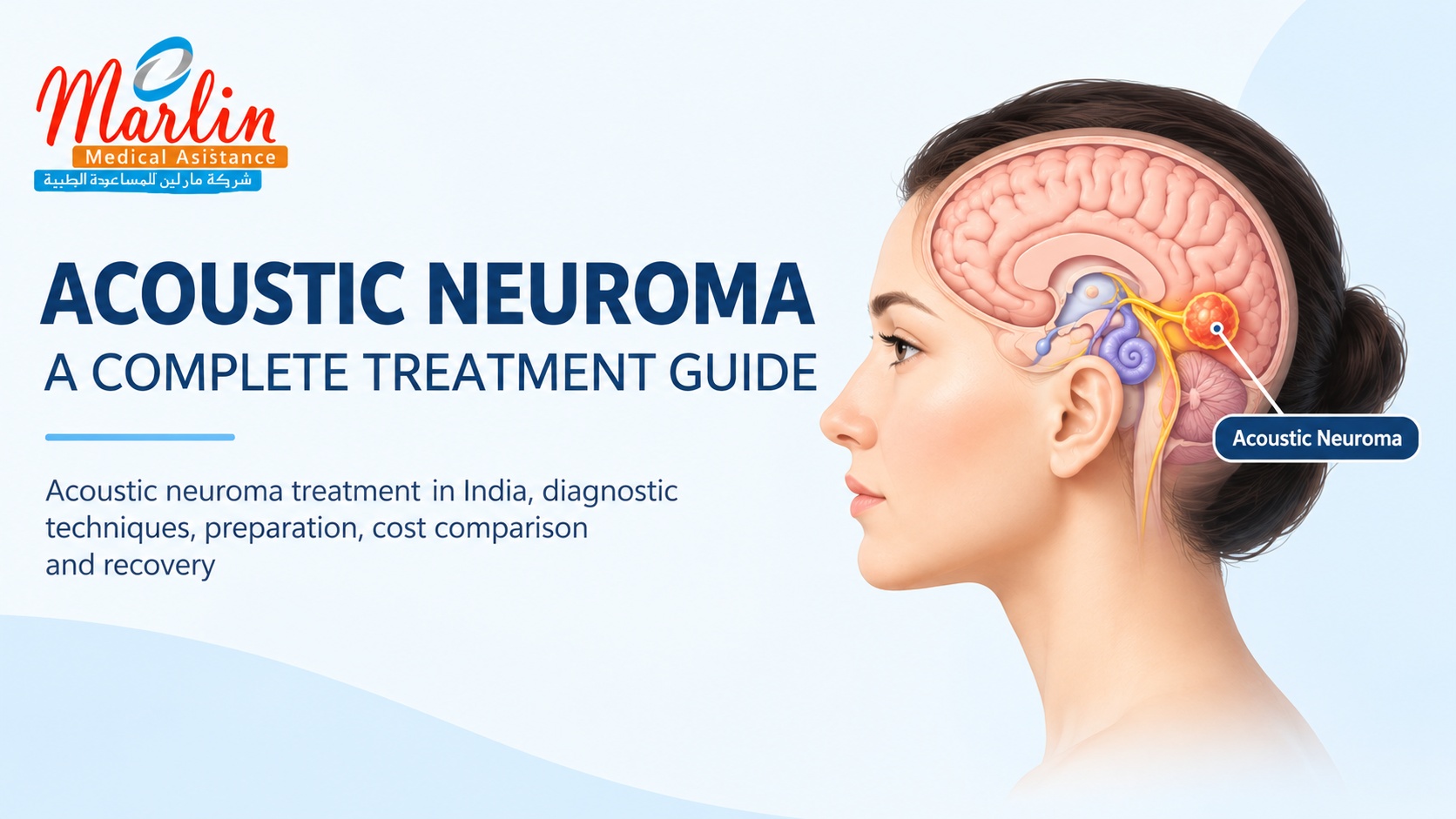 Acoustic Neuroma Treatment in India, Diagnostic Techniques, Preparation, Cost Comparison and Recovery
