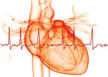 Cardiac Arrhythmia