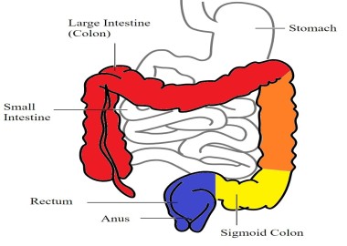 Inflammatory Bowel Disease (IBD)