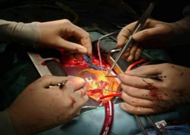 Heart Bypass Surgery