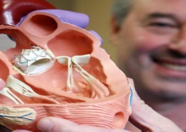 Heart Valve Replacement